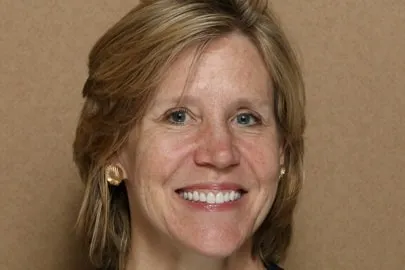 Patient face after full-mouth reconstruction